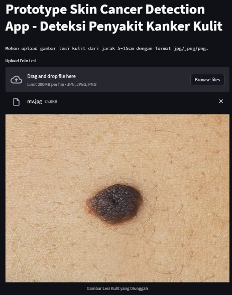 Skin Cancer Detection